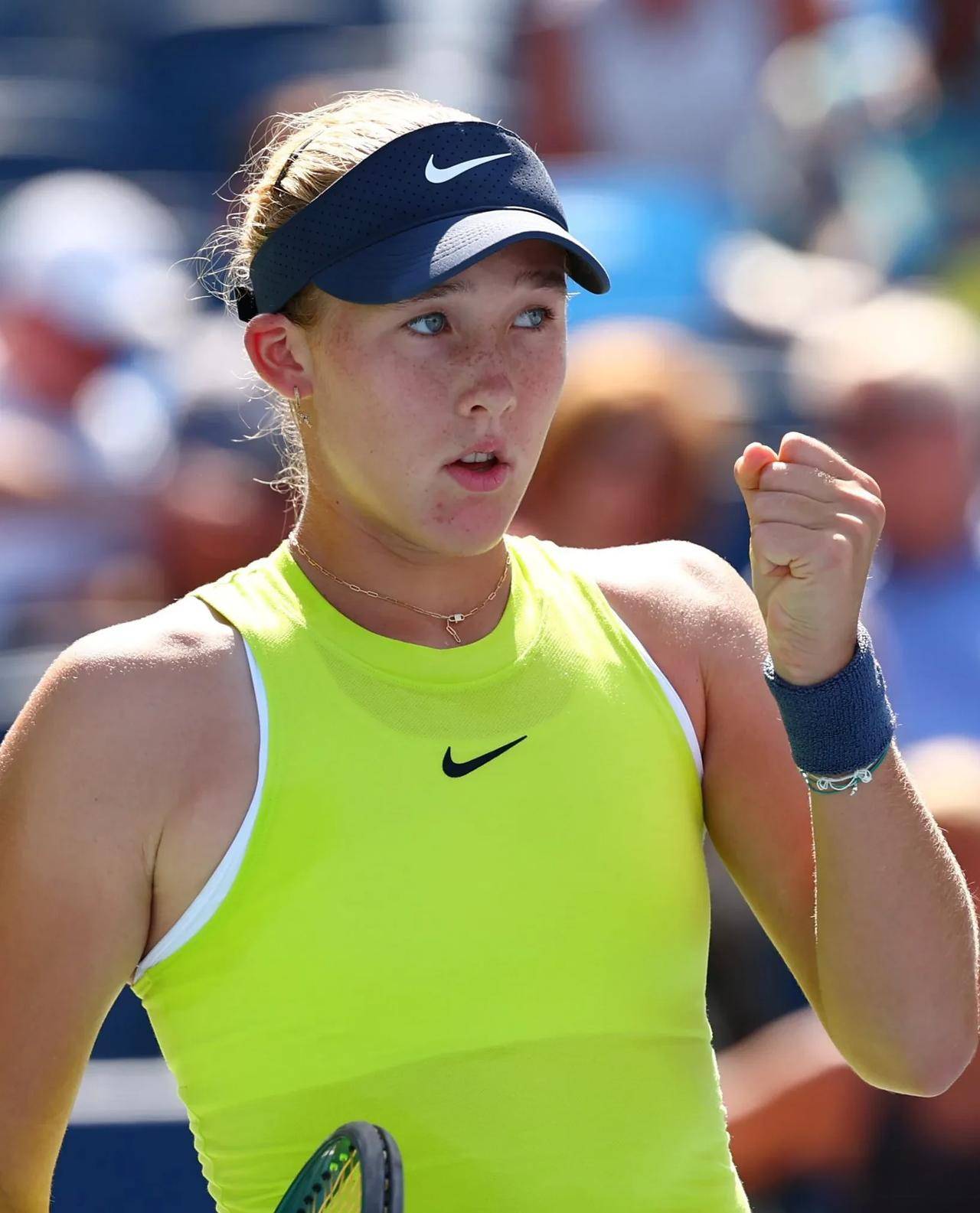 广泛关注 广泛关注